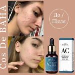 cos de baha azelaic acid hinokitiol clear skin 30ml - Image 4