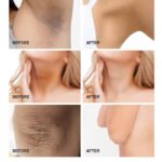 3W Clinic Underarm Whitening Multi Cream 100g - Image 2