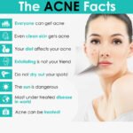 Baby Bright Clear & Treat Acne Cleansing Foam 120g - Image 2