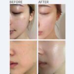Heimish All Clean Vitamin Blemish Spot Clear Cream 10ml (mini) - Image 2