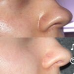 Isntree Hyaluronic Acid Toner Plus 20 ml - Image 2