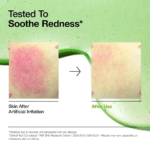 ANUA Azelaic Acid 10 Hyaluron Redness Soothing Serum 30ml - Image 4